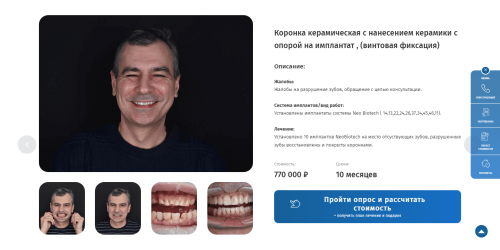 Готовый сайт-квиз имплантация зубов Готовый сайт-квиз имплантация зубов